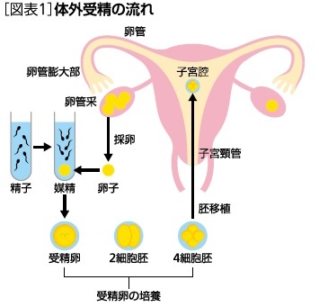 最近の不妊治療について ニッセイ基礎研究所