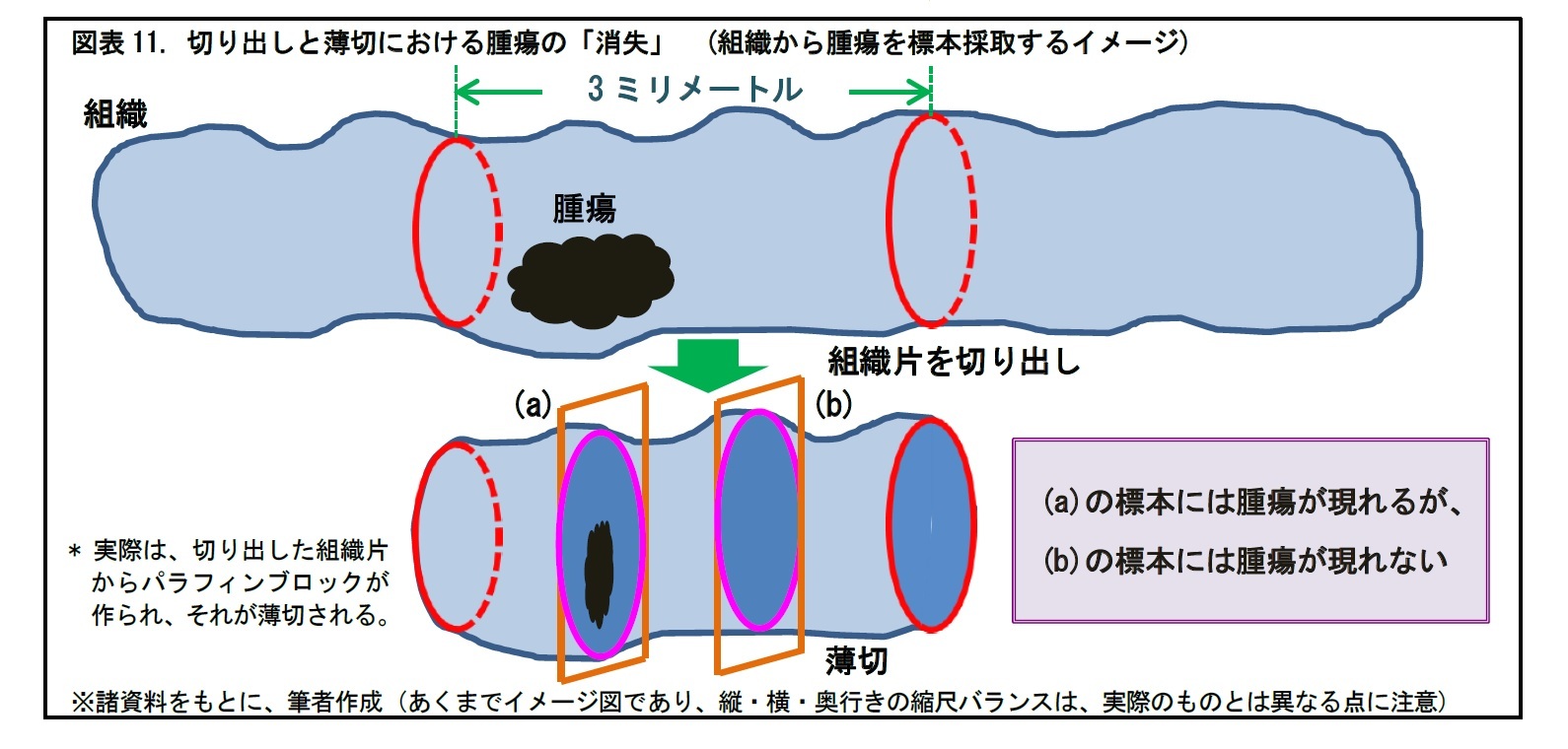 図表11. 切り出しと薄切における腫瘍の「消失」 (組織から腫瘍を標本採取するイメージ)