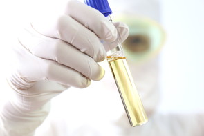 進化する「ドライブスルー」-新型コロナウイルスの検査以外にも活用-