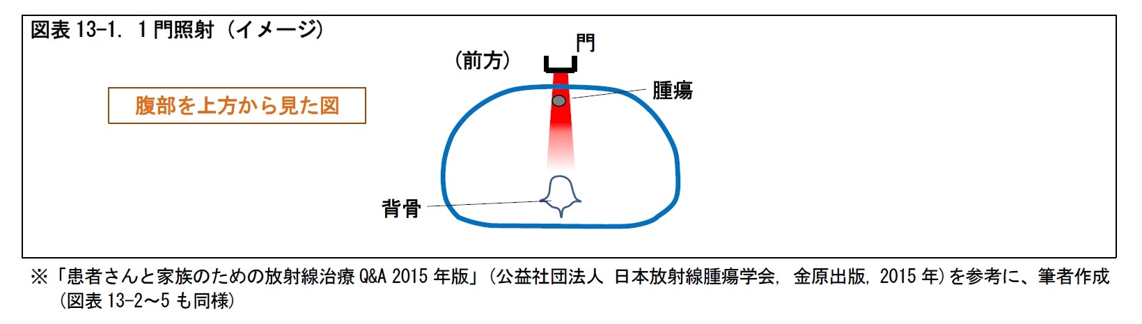 図表13-1. 1 門照射 (イメージ)
