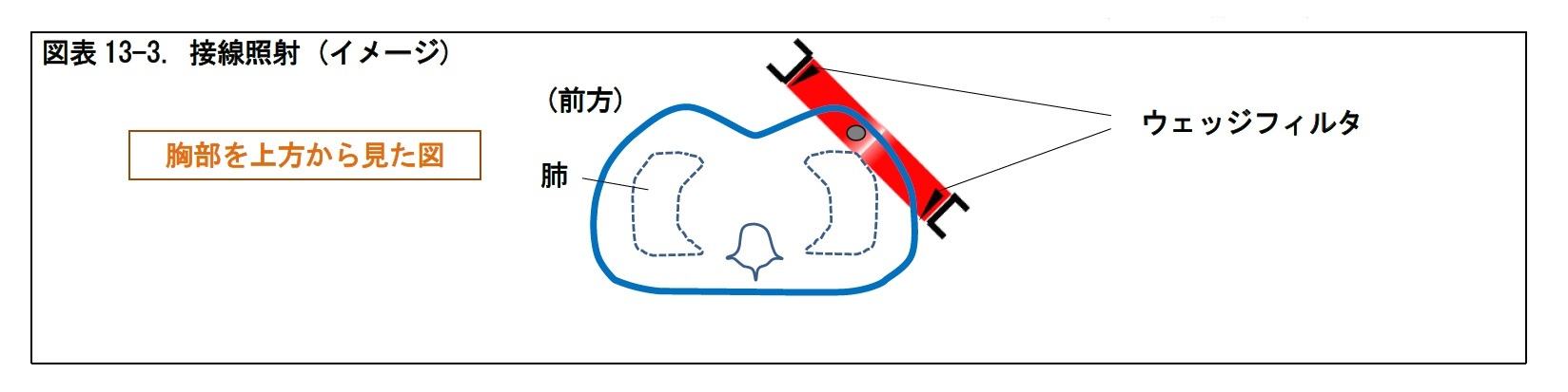 図表13-3. 接線照射 (イメージ)