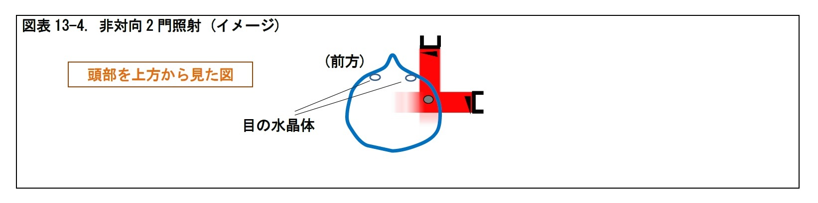 図表13-4. 非対向2 門照射 (イメージ)