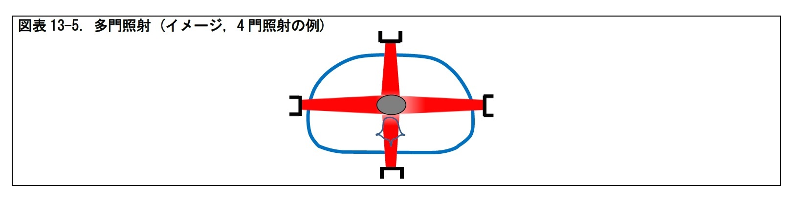 図表13-5. 多門照射 (イメージ, 4 門照射の例)