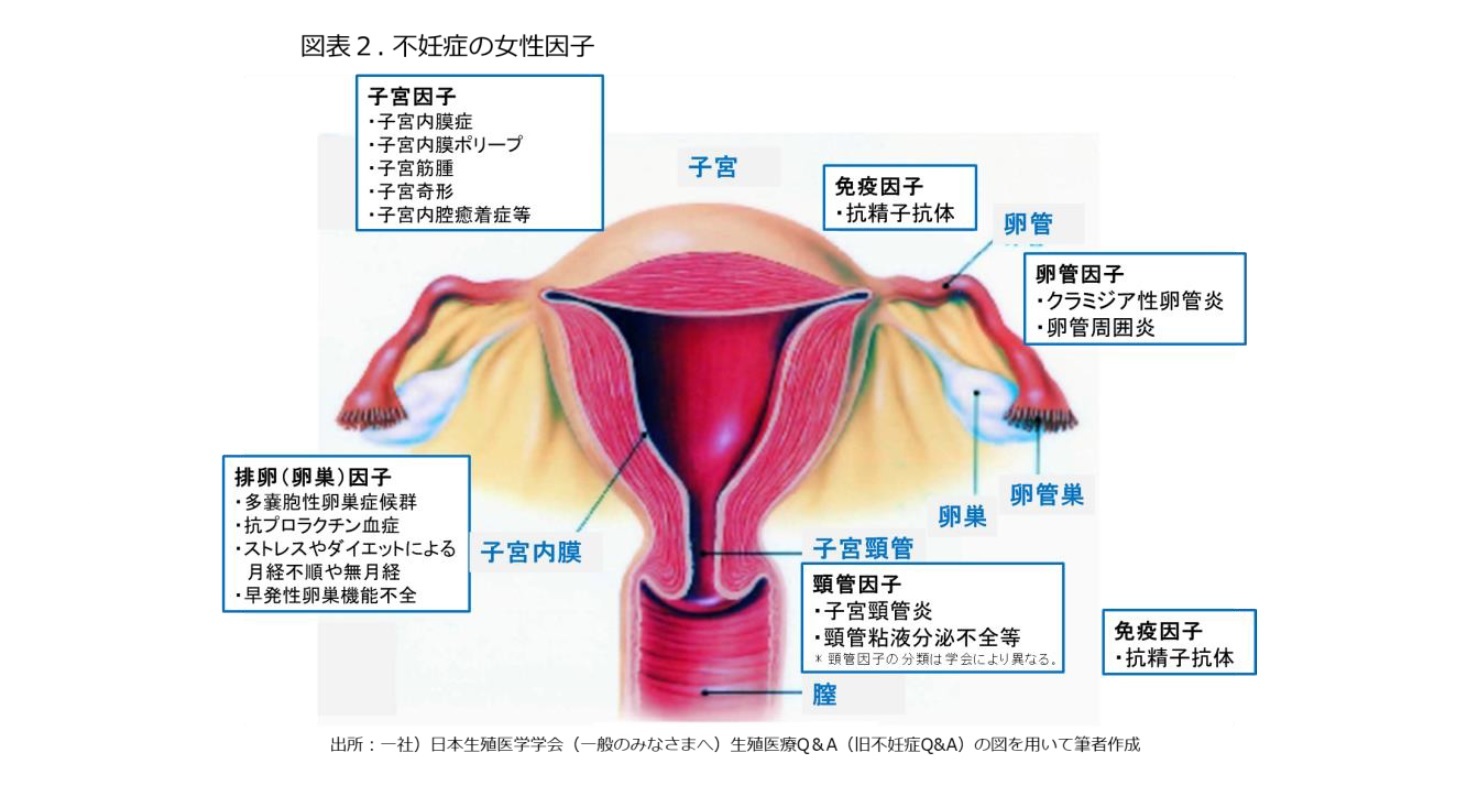 図表2.不妊症の女性因子